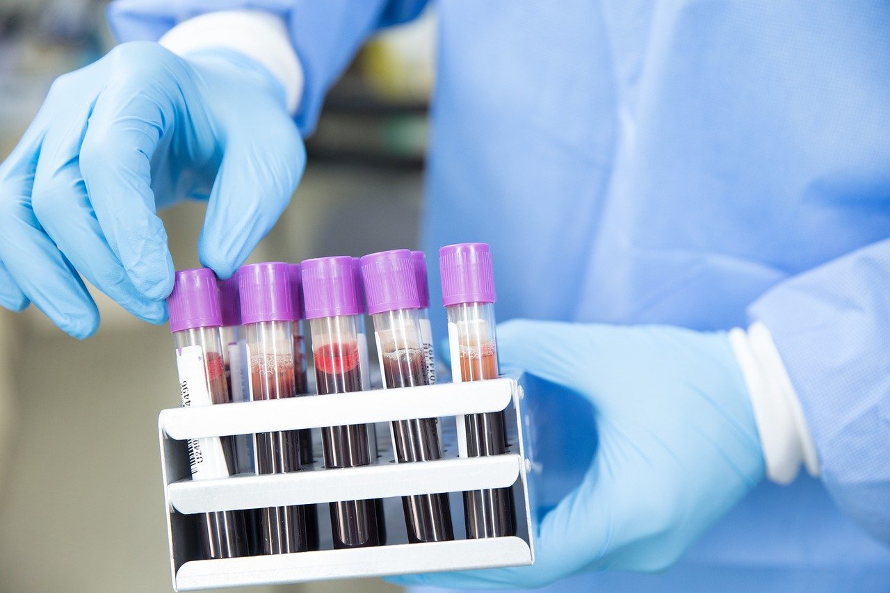 blood-g249fbc63b_1280